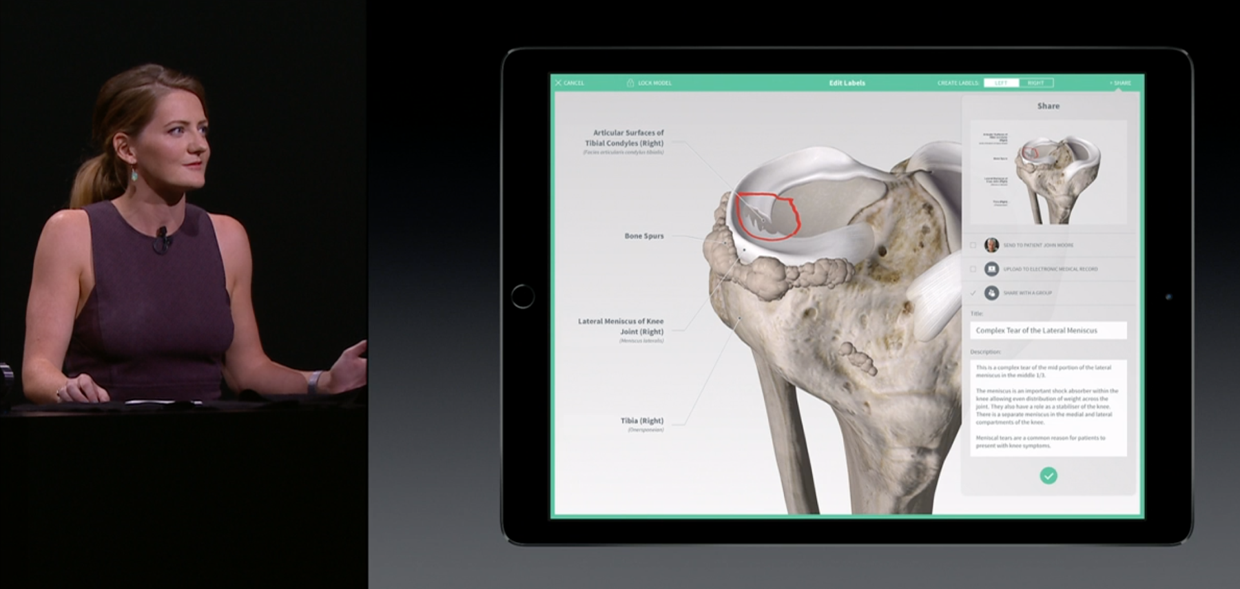 iPad Pro - 3D for Medical