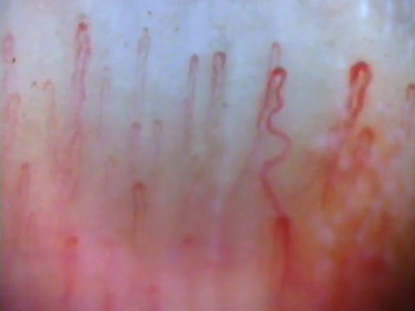 capillary image
