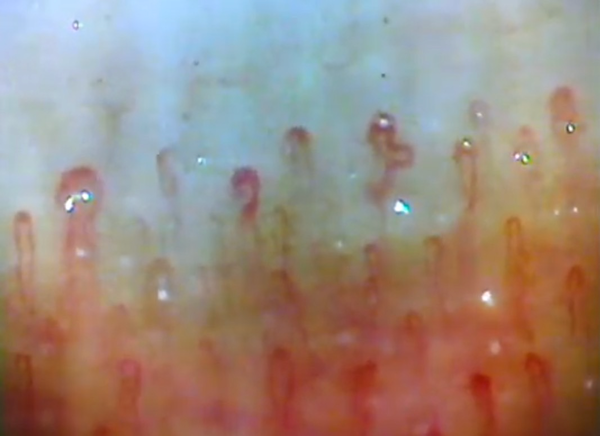 capillary image