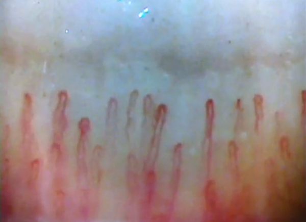 capillary image